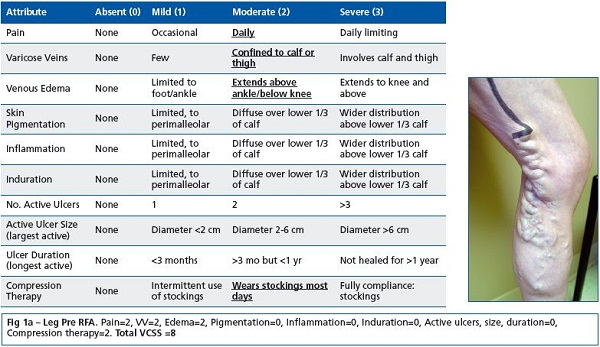 figure 1a figure 1a