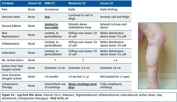 Figure 1b Figure 1b