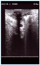 Figure 17 Figure 17