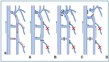 Figure 18A/B/C/D Figure 18A/B/C/D