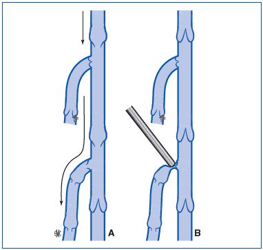 Figure 19 Figure 19