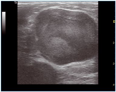 Figure 6 Figure 6
