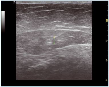 Figure 7 Figure 7