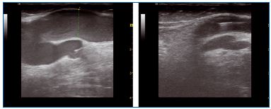Figure 9 Figure 9