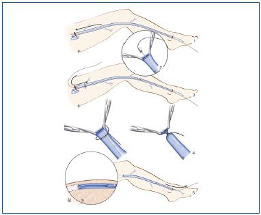 Figure 10 Figure 10