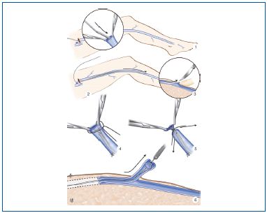 Figure 12 Figure 12