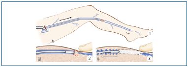 Figure 13 Figure 13