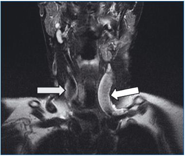 Figure 2 Figure 2
