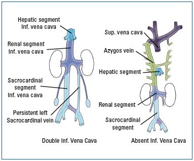 Figure 12 Figure 12