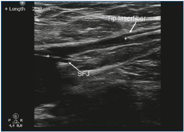 Figure 1 Figure 1