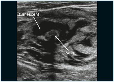 Figure 2 Figure 2