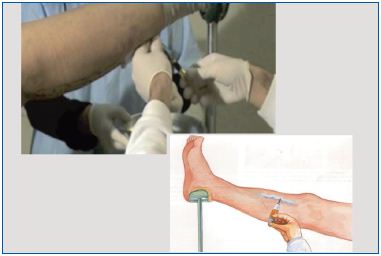 Figure 2 Figure 2