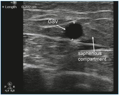 Figure 3 Figure 3