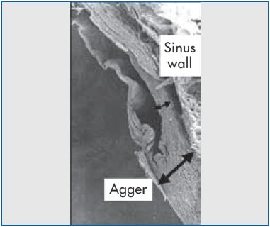 Figure 4 Figure 4