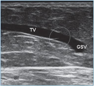Figure 6 Figure 6