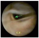 Figure 6 Figure 6