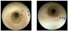 Figure 11 Figure 11