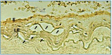 Figure 12 Figure 12
