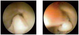 Figure 14 Figure 14