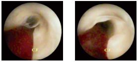 Figure 15 Figure 15