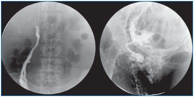 Figure 4 Figure 4