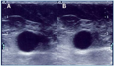 Figure 3 Figure 3