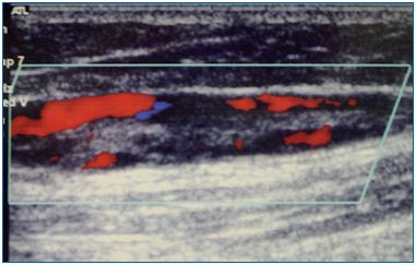 Figure 4 Figure 4