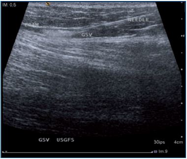 Figure 1 Figure 1