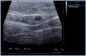 Figure 2 Figure 2