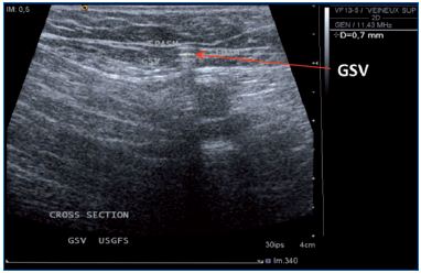 Figure 3 Figure 3
