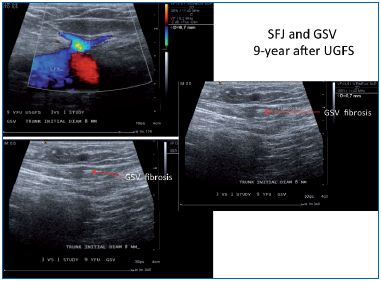 Figure 6 Figure 6
