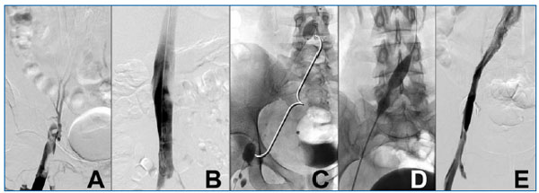 Figure 1 Figure 1