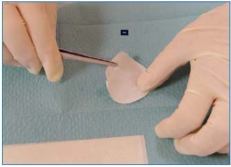 Figure 4 Figure 4