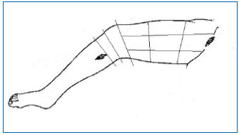 Figure 1 Figure 1