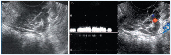 Figure 1 Figure 1