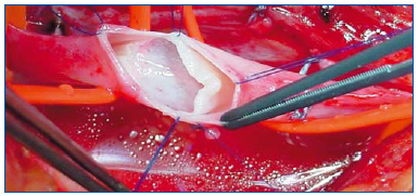 Figure 4 Figure 4