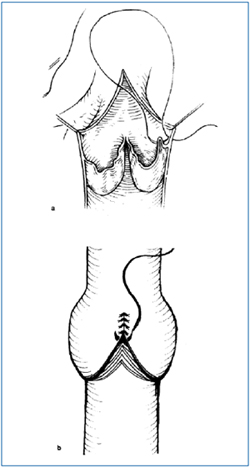 Figure 2 Figure 2