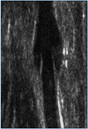 Figure 1 Figure 1