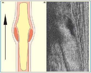 Figure 2 Figure 2