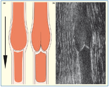 Figure 4 Figure 4