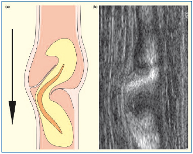 Figure 5 Figure 5