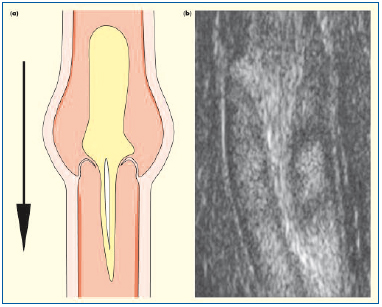 Figure 7 Figure 7