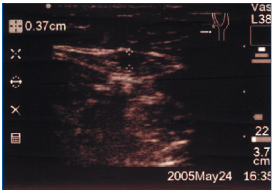 Figure 1 Figure 1