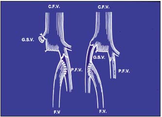 Figure 4 Figure 4