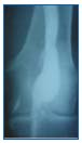 Figure 1 Figure 1