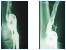 Figure 3 and 4 Figure 3 and 4