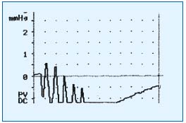 Figure 1 Figure 1