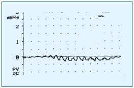 Figure 2 Figure 2