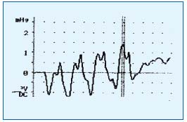 Figure 3 Figure 3