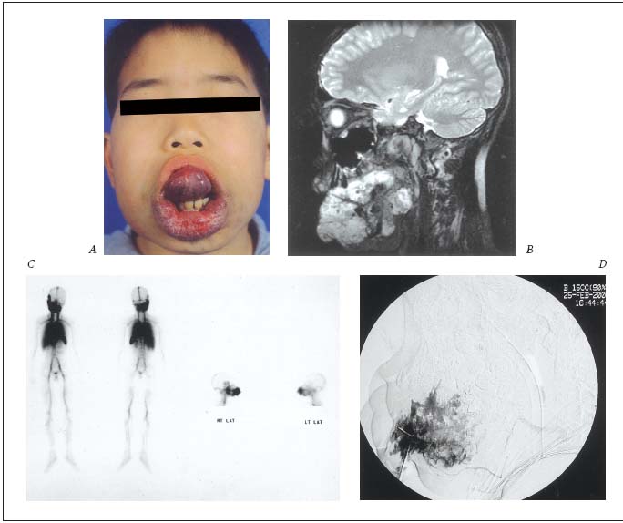 Figure 1-A Figure 1-A